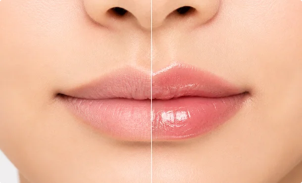 creates-a-plump‑looking‑effect