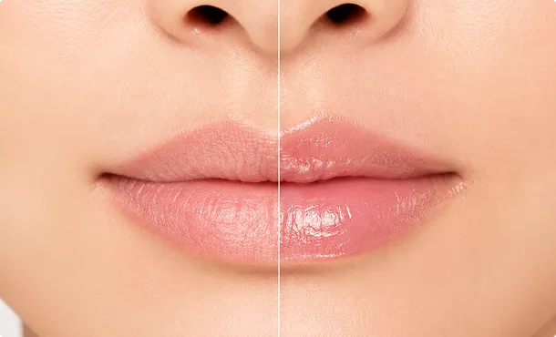 deeply-moisturizes-lips