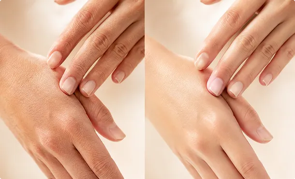 repairs-dry-hands
